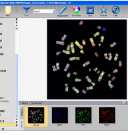 染色体荧光原位杂交软件